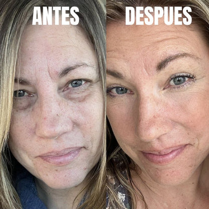 Luminique™: Terapia ocular 2 en 1  con luz roja y EMS