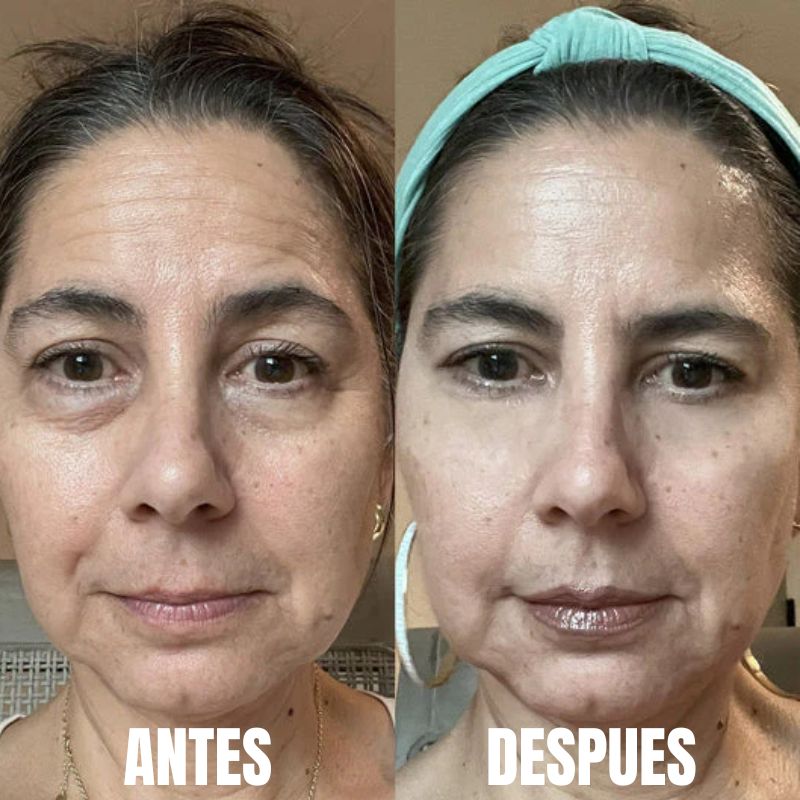 Luminique™: Terapia ocular 2 en 1  con luz roja y EMS