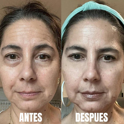 Luminique™: Terapia ocular 2 en 1  con luz roja y EMS